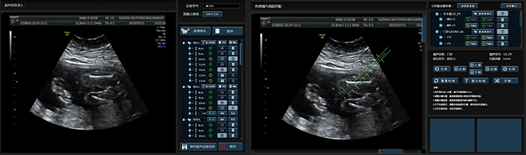 医疗科技超声系统软件界面设计